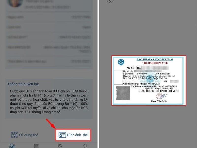 Cách sử dụng VssID để đi khám chữa bệnh bước 4