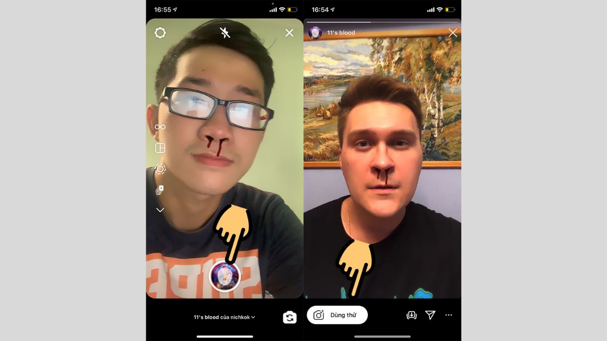 Filter chảy máu mũi